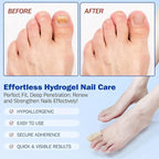 Fungal Nail Treatment Patches – Fast-Acting Antifungal Repair for Healthy Nails