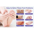 Goat Milk Exfoliating Foot Mask with Nicotinamide | Deep Moisturising & Dead Skin Removal Foot Mask