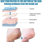 Goat Milk Exfoliating Foot Mask with Nicotinamide | Deep Moisturising & Dead Skin Removal Foot Mask